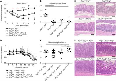 Divergent Roles of Interferon-γ and Innate Lymphoid Cells in Innate and Adaptive Immune Cell-Mediated Intestinal Inflammation